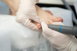 Un soin podologique